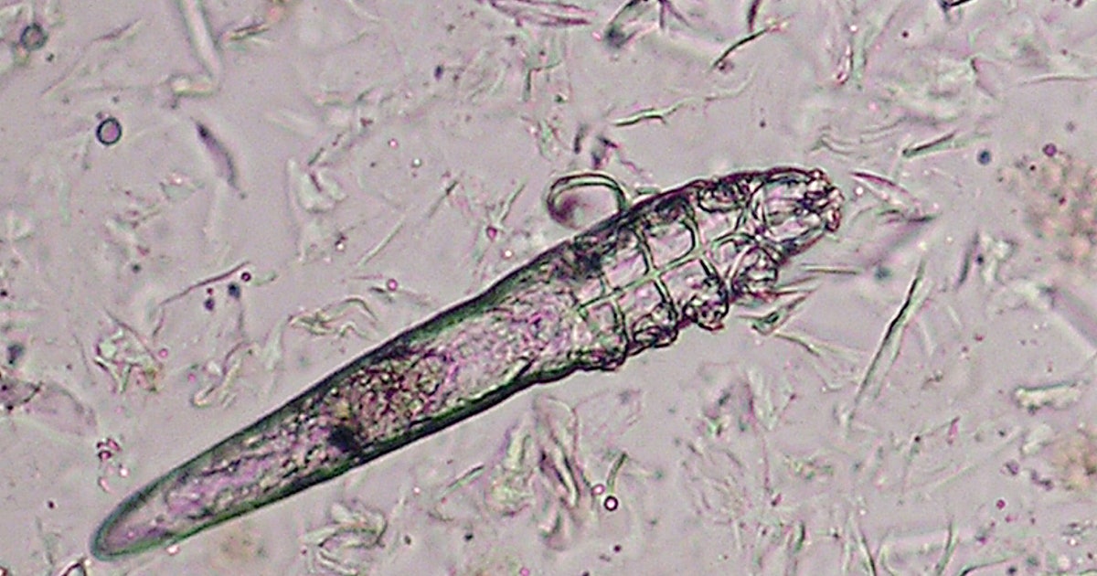 Yes, there are mites living on your face — and they can poop, a new study finds