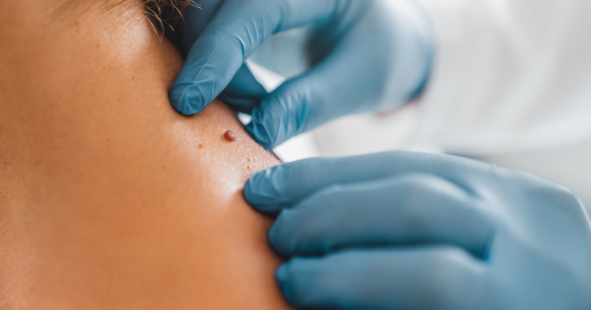 Dermatologists reveal how to stay safe and when to worry