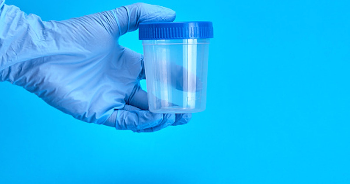 Is it finally time to stop drug testing workers?