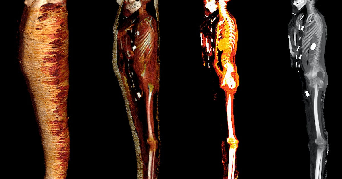 ‘Golden Boy’ mummy CT scans reveal 2,300-year-old burial traditions