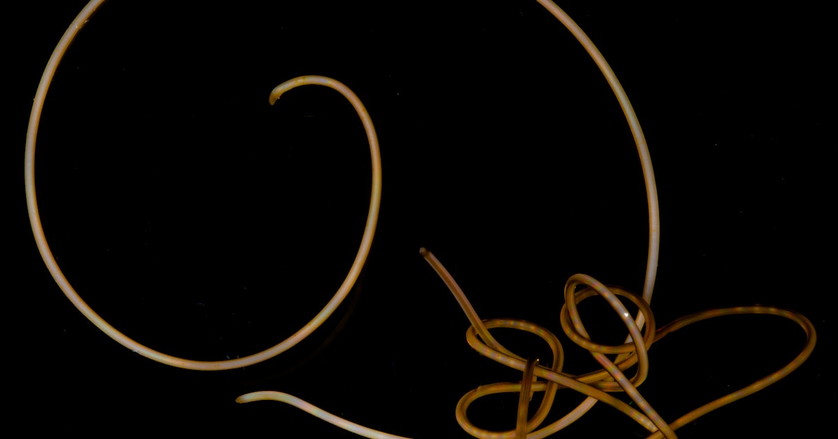 This Mind-Controlling Parasitic Worm Is Missing Genes Found In Nearly All Animals